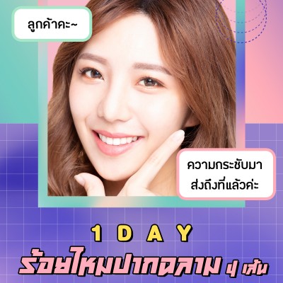 1 Day ร้อยไหมปากฉลาม 4 เส้น