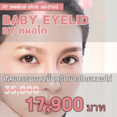 BABY EYELID BY หมอไก่