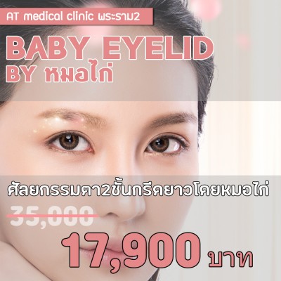 BABY EYELID BY หมอไก่