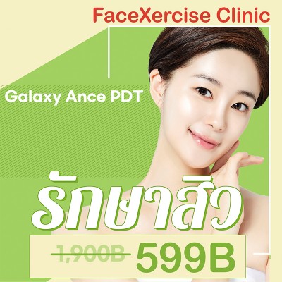 การรักษาสิว Galaxy Ance PDT