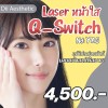 Laser หน้าใส Q-Switch Nd YAG