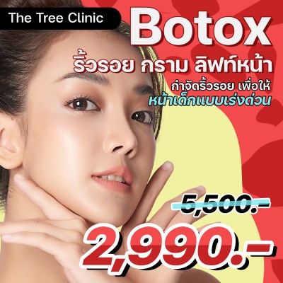 BOTOX ริ้วรอย กราม ลิฟท์หน้า