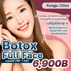 Botox - Full Face โบท็อกซ์ทั้งใบหน้า