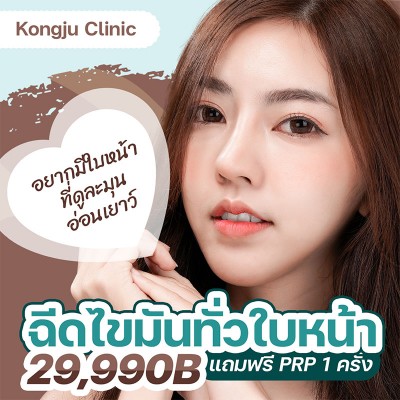 ฉีดไขมันทั่วใบหน้า แถมฟรี PRP