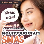 ศัลยกรรมดึงหน้า SMAS