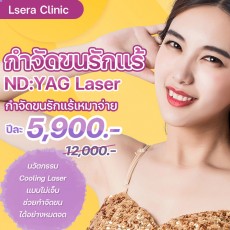 กำจัดขนรักแร้ ND:YAG Laser