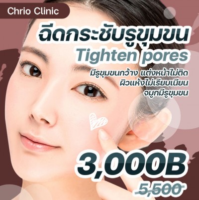 ฉีดกระชับรูขุมขน Tighten Pores