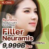 Filler Neuramis 3cc