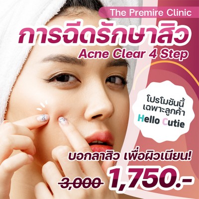 การฉีดรักษาสิว Acne Clear 4 Step