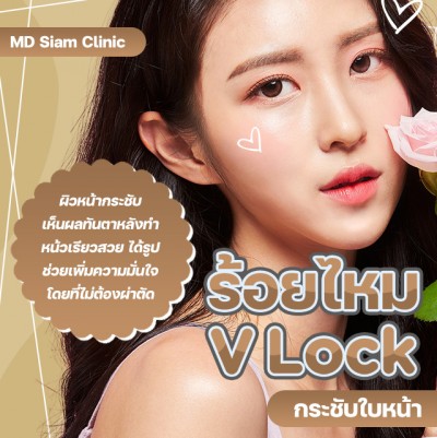 ร้อยไหม V-Lock กระชับใบหน้า