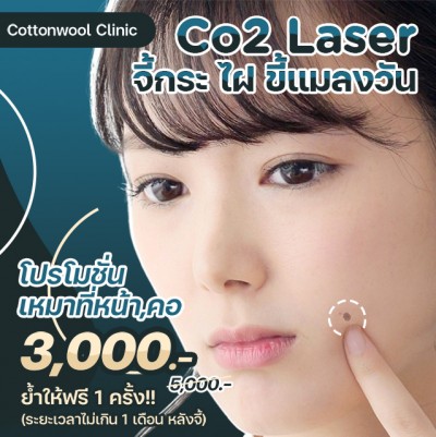 จี้กระ ไฝ ขี้แมลงวัน CO2 Laser