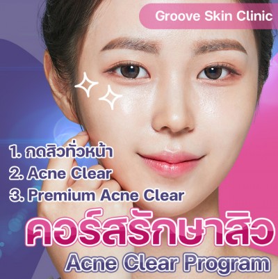 คอร์สรักษาสิว Acne Clear Program