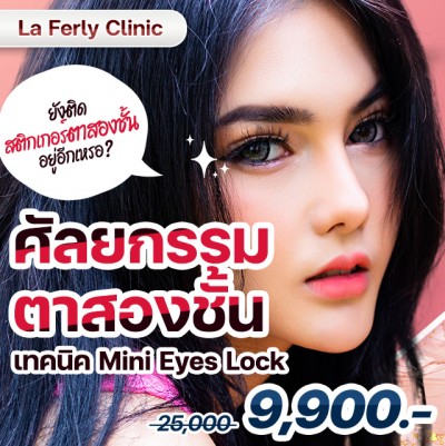 ศัลยกรรมตาสองชั้น เทคนิค Mini Eyes Lock